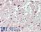 Von Willebrand Factor A Domain Containing 5A antibody, LS-B11755, Lifespan Biosciences, Immunohistochemistry paraffin image 