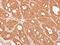 Catenin Alpha 3 antibody, GTX115881, GeneTex, Immunohistochemistry paraffin image 