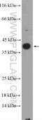 Interleukin 1 Beta antibody, 16806-1-AP, Proteintech Group, Western Blot image 