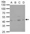 Glutamate-Ammonia Ligase antibody, GTX630654, GeneTex, Western Blot image 