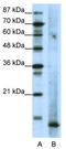 MDS1 and EVI1 complex locus protein MDS1 antibody, TA343493, Origene, Western Blot image 
