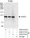 Signal Transducer And Activator Of Transcription 2 antibody, A303-510A, Bethyl Labs, Immunoprecipitation image 