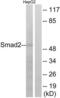 HsMAD2 antibody, LS-C117926, Lifespan Biosciences, Western Blot image 