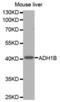 Alcohol Dehydrogenase 1B (Class I), Beta Polypeptide antibody, abx001235, Abbexa, Western Blot image 