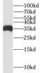 Succinate-CoA Ligase Alpha Subunit antibody, FNab08370, FineTest, Western Blot image 