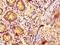 Epidermal growth factor receptor kinase substrate 8 antibody, LS-C670122, Lifespan Biosciences, Immunohistochemistry paraffin image 