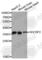 Syndecan Binding Protein 2 antibody, A4643, ABclonal Technology, Western Blot image 