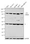 Tumor Protein P73 antibody, MA5-16167, Invitrogen Antibodies, Western Blot image 