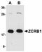 Zinc Finger CCHC-Type And RNA Binding Motif Containing 1 antibody, orb75221, Biorbyt, Western Blot image 