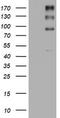 ALK Receptor Tyrosine Kinase antibody, TA801296BM, Origene, Western Blot image 