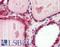 Cathepsin K antibody, LS-B2512, Lifespan Biosciences, Immunohistochemistry frozen image 