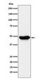 Ectonucleoside Triphosphate Diphosphohydrolase 5 (Inactive) antibody, M06908-1, Boster Biological Technology, Western Blot image 