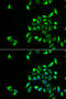 Casein kinase I isoform alpha-like antibody, STJ28573, St John