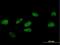 F-box only protein 31 antibody, H00079791-B01P, Novus Biologicals, Immunofluorescence image 