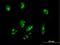 Chromosome 1 Open Reading Frame 87 antibody, H00127795-B01P, Novus Biologicals, Immunocytochemistry image 