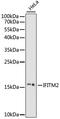 Interferon Induced Transmembrane Protein 2 antibody, 15-894, ProSci, Western Blot image 