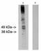 Ceramide Synthase 2 antibody, PA1-12922, Invitrogen Antibodies, Western Blot image 