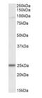 NADH dehydrogenase [ubiquinone] iron-sulfur protein 8, mitochondrial antibody, orb97634, Biorbyt, Western Blot image 