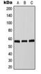 Tyrosine Hydroxylase antibody, LS-C354113, Lifespan Biosciences, Western Blot image 