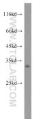 Deoxyribonuclease 2, Lysosomal antibody, 15934-1-AP, Proteintech Group, Western Blot image 