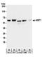 N-Myristoyltransferase 1 antibody, A304-254A, Bethyl Labs, Western Blot image 