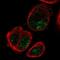 Solute Carrier Family 16 Member 9 antibody, NBP2-31030, Novus Biologicals, Immunofluorescence image 