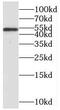 Myocyte Enhancer Factor 2C antibody, FNab05106, FineTest, Western Blot image 
