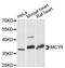 Melanocortin 1 Receptor antibody, A13152, ABclonal Technology, Western Blot image 