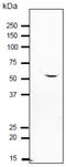Izumo Sperm-Egg Fusion 1 antibody, GTX00746, GeneTex, Western Blot image 