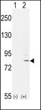 Fibroblast Growth Factor Receptor 1 antibody, LS-C166143, Lifespan Biosciences, Western Blot image 