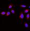 Gelsolin antibody, PA2109, Boster Biological Technology, Immunofluorescence image 