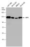 Huntingtin Interacting Protein 1 antibody, GTX131449, GeneTex, Western Blot image 