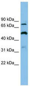 Sulfate anion transporter 1 antibody, TA333711, Origene, Western Blot image 