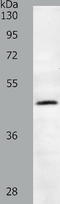 Sperm Associated Antigen 4 antibody, TA322904, Origene, Western Blot image 