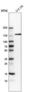 5-azacytidine-induced protein 1 antibody, NBP1-90053, Novus Biologicals, Western Blot image 