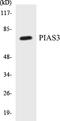 Protein Inhibitor Of Activated STAT 3 antibody, EKC1458, Boster Biological Technology, Western Blot image 
