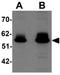 Zinc Finger And BTB Domain Containing 3 antibody, GTX17095, GeneTex, Western Blot image 