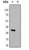 Herpes Simplex Virus tag antibody, LS-C368990, Lifespan Biosciences, Western Blot image 