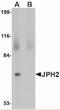 Junctophilin 4 antibody, NBP2-41093, Novus Biologicals, Western Blot image 