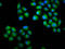 Chondrolectin antibody, LS-C680275, Lifespan Biosciences, Immunofluorescence image 