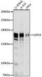Ubiquitin carboxyl-terminal hydrolase 19 antibody, A9723, ABclonal Technology, Western Blot image 