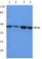 Casein Kinase 1 Alpha 1 antibody, AP06696PU-N, Origene, Western Blot image 