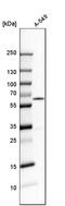 RAD23 Homolog B, Nucleotide Excision Repair Protein antibody, HPA029720, Atlas Antibodies, Western Blot image 