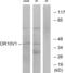 Olfactory Receptor Family 10 Subfamily V Member 1 antibody, abx015401, Abbexa, Western Blot image 