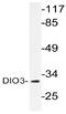 Iodothyronine Deiodinase 3 antibody, AP20592PU-N, Origene, Western Blot image 