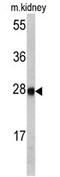 ETHE1 Persulfide Dioxygenase antibody, AP17350PU-N, Origene, Western Blot image 