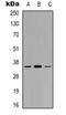 Gamma-Glutamyl Hydrolase antibody, orb319017, Biorbyt, Western Blot image 
