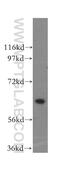 2-Hydroxyacyl-CoA Lyase 1 antibody, 15519-1-AP, Proteintech Group, Western Blot image 