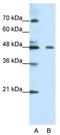 Zinc finger protein 645 antibody, TA341489, Origene, Western Blot image 