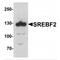 Sterol Regulatory Element Binding Transcription Factor 2 antibody, MBS153389, MyBioSource, Western Blot image 